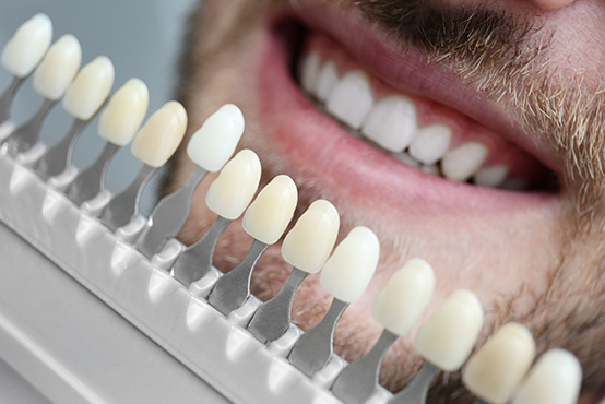 Abercorn Dental | Oral Exams, Ceramic Crowns and Dental Bridges